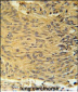 LCLT1 Antibody (C-term)